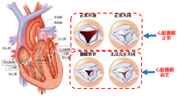 心脏二三尖瓣供血图图片